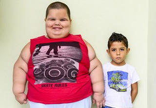 Cậu bé 5 tuổi nặng... hơn 80 kg