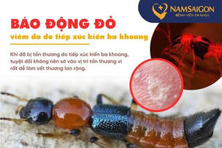 Kiến ba khoang hoành hành