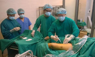 Điều trị suy tĩnh mạch chi dưới bằng laser