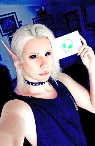 Chàng trai phẫu thuật thành... yêu tinh