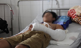 Nam thanh niên bị máy hút lúa ‘nuốt’ một cánh tay