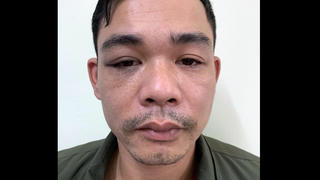 Đánh thuốc mê bạn gái 3 lần để cướp iPhone 11