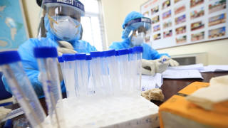 Việt Nam xuất hiện biến chủng Covid-19 ‘đột biến kép’ từ Ấn Độ