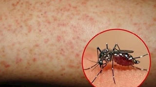 Khánh Hòa: Nguy cơ bùng phát dịch sốt xuất huyết