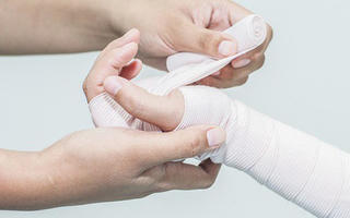 Không nên tự đắp thuốc lá chữa bỏng