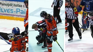 Trọng tài gãy gần hết răng khi bị bóng đập cực mạnh vào mặt