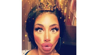 Người phụ nữ chi nghìn đô để có đôi môi cá hồi