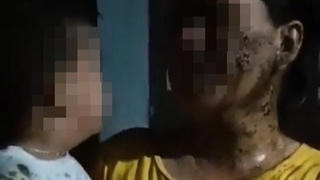 Khởi tố bị can đổ chất bẩn lên người bé trai 2 tuổi để đòi nợ