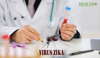 Bệnh nhân nghi ngờ bệnh do virus Zika được xét nghiệm miễn phí