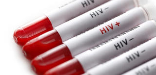 8.000 trường hợp nhiễm HIV được phát hiện mỗi năm