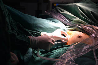 Việt Nam thực hiện nội soi tuyến giáp một lỗ lần đầu thành công trên thế giới