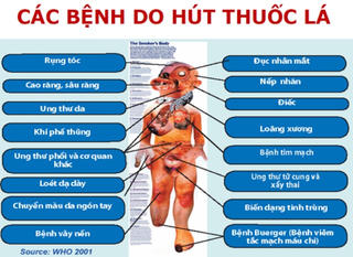 Cần thiết phải tăng thuế thuốc lá