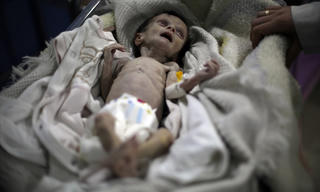 Khủng hoảng lương thực Syria qua hình ảnh em bé chết đói