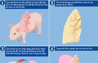 Hy vọng mới cho người cần ghép tạng: Nuôi cấy thành công phổi mới