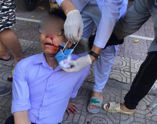 Cán bộ phường bị 2 thanh niên lạ mặt đánh bất tỉnh trên đường