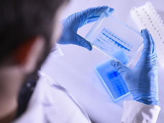 Nhật Bản bào chế vaccine giúp loại bỏ các tế bào lão hóa