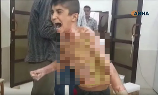 [ẢNH] Những đứa trẻ Syria bị trúng bom trong chiến sự dữ dội của Thổ Nhĩ Kỳ