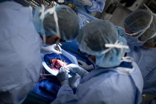 Ca ghép gan giữa 2 bệnh nhân nhiễm HIV đầu tiên thành công