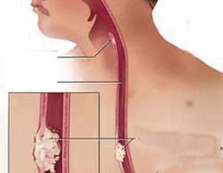 Cần Thơ: Hội thảo khoa học 'Ung thư tiêu hóa và đầu cổ'
