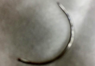 Cây kim khâu thất lạc trong vùng kín sản phụ