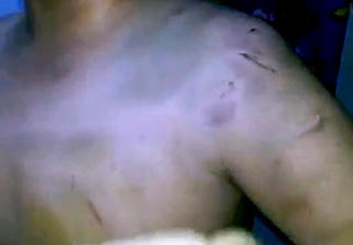 Bé trai 9 tuổi bị mẹ đánh bầm tím cơ thể