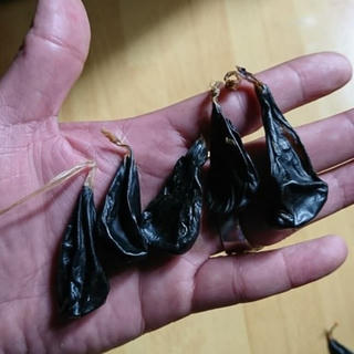 Cháu bé 9 ngày tuổi ngừng thở, tím tái khi gia đình cho uống mật khỉ