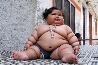 Bé gái 8 tháng tuổi nặng 19kg