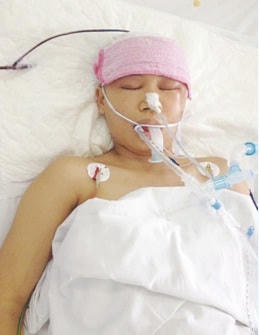 Cứu sống sản phụ bị tai biến mạch máu não