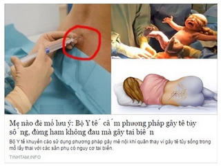 Nóng chuyện gây tê tuỷ sống khi mổ lấy thai