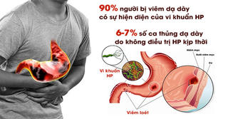 Nguy cơ đến từ vi khuẩn H.P