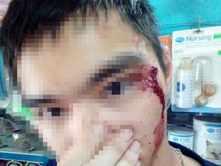 Tài xế Grab đánh người vì không nhường đường?