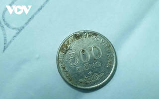 Gắp thành công dị vật đồng xu cho bé gái 6 tuổi