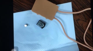 Phải phẫu thuật vì sử dụng thiết bị gian lận trong thi cử