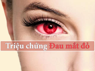 Khó chịu với đau mắt đỏ