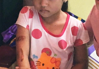 Bé gái nghi bị cha, mẹ kế dí sắt nung đỏ đã bỏ học và 'biến mất'