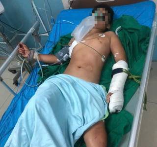 Cháu bé sống sót trong vụ thảm án tại Đắk Lắk đang được điều trị tích cực