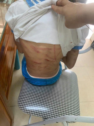  Hà Tĩnh: Cô giáo kể về bé gái bị cha dượng bạo hành bằng búa