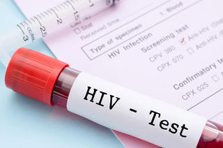 Phòng chống HIV/AIDS: Thách thức vẫn hiện hữu