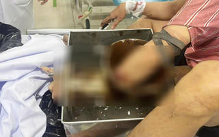 Tai nạn lao động dịp cận Tết: Hậu quả nặng nề của một phút lơ là