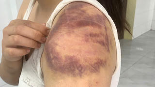 Làm rõ vụ án đối tượng ngược đãi, hành hạ vợ, con